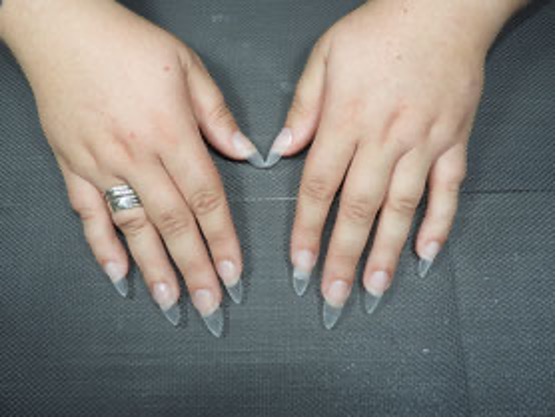 softgel